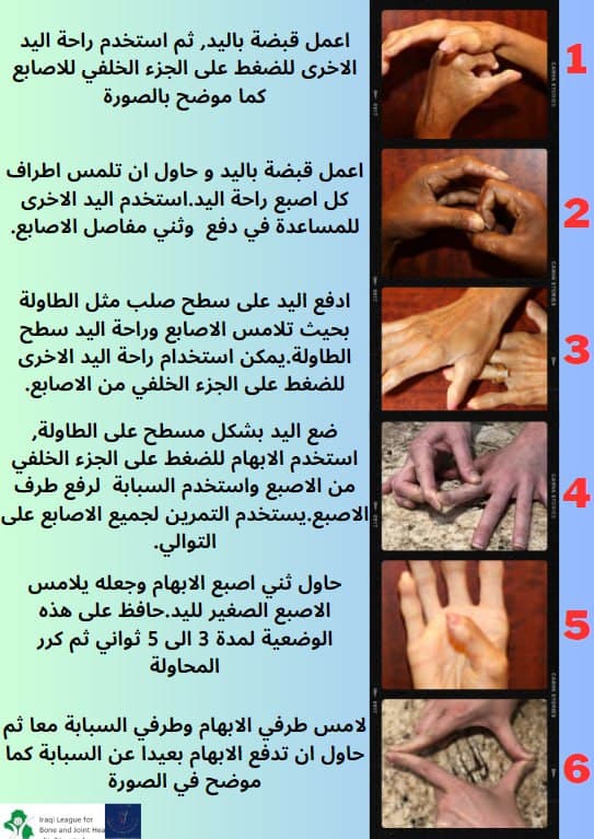 Scleroderma: Therapeutic Exercise Posters by Dr. Shahlaa Ali